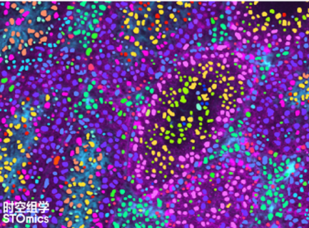 时空转录组兼容多重免疫荧光产品方案